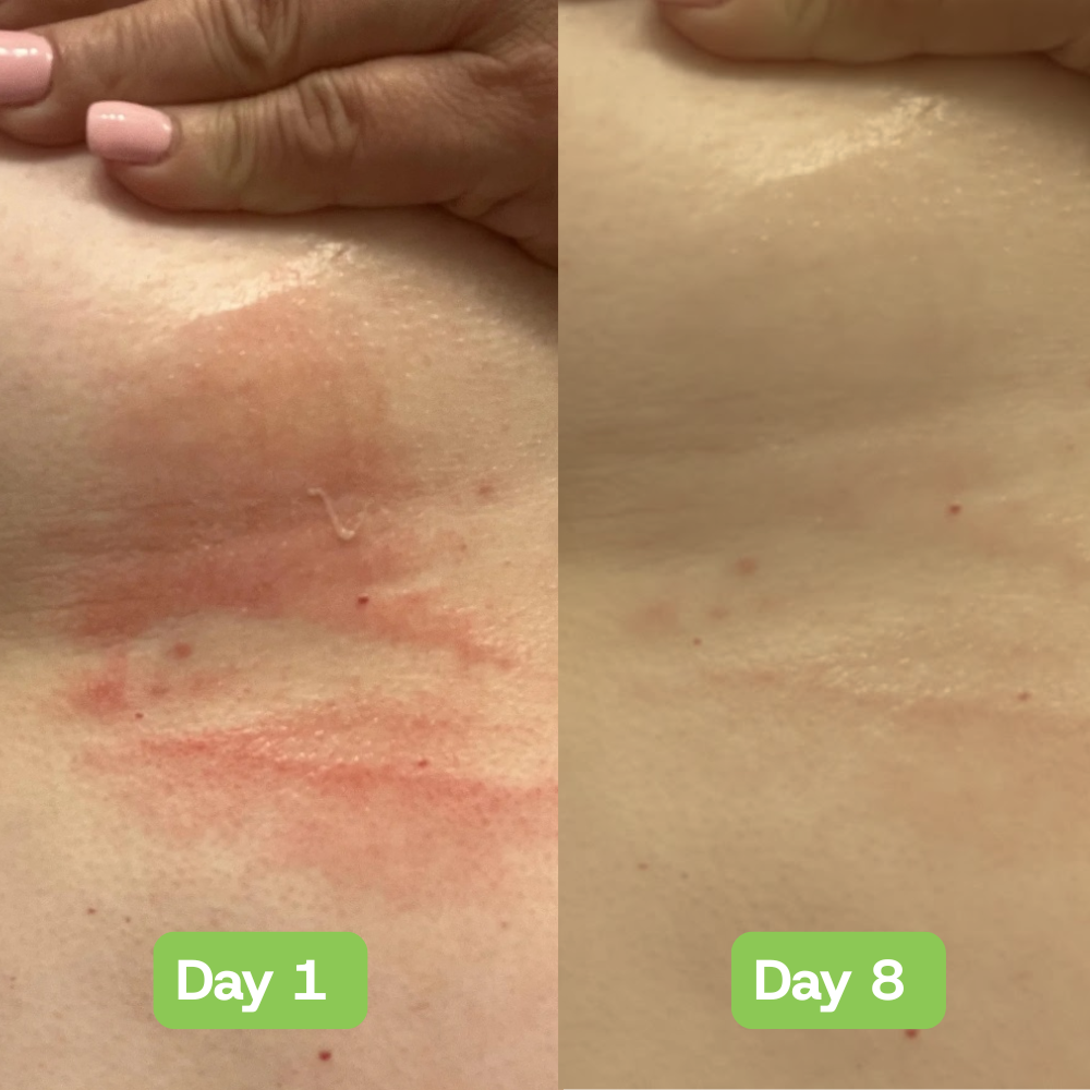 Veloria AntiFungal Relief