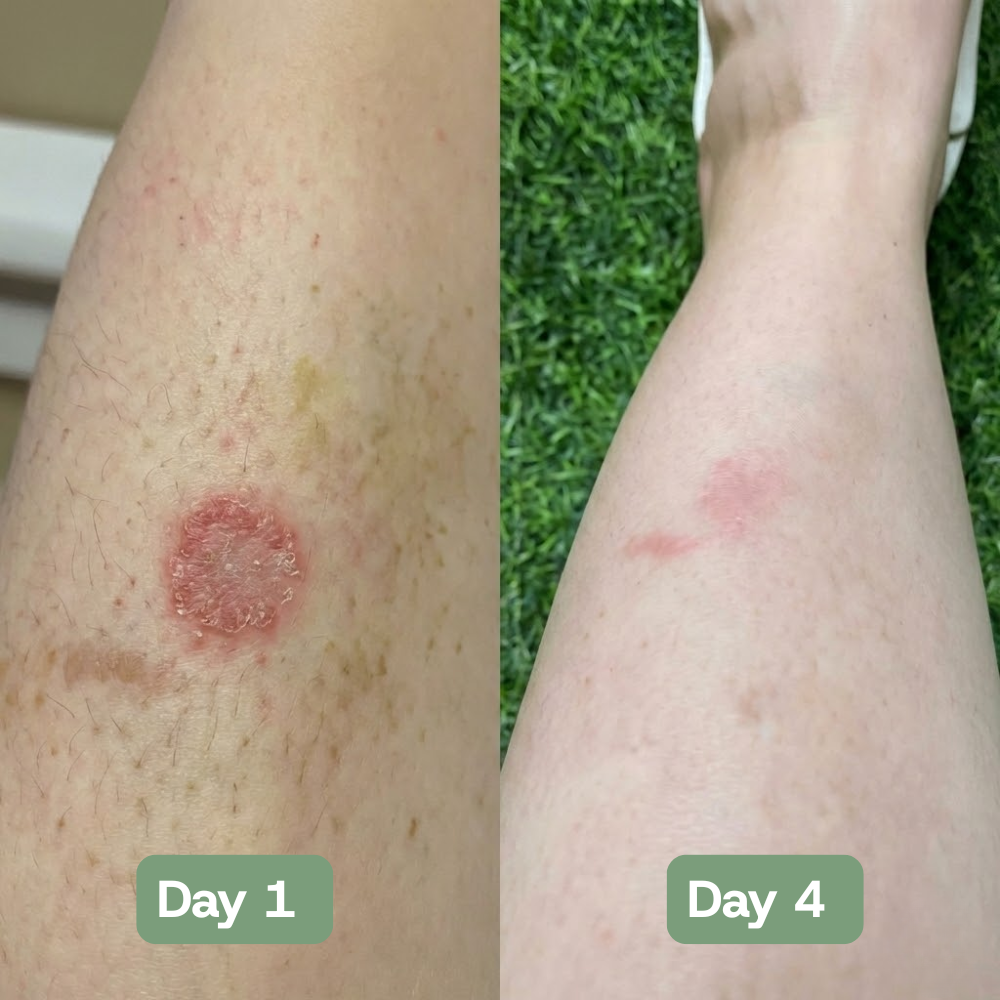 Veloria AntiFungal Relief