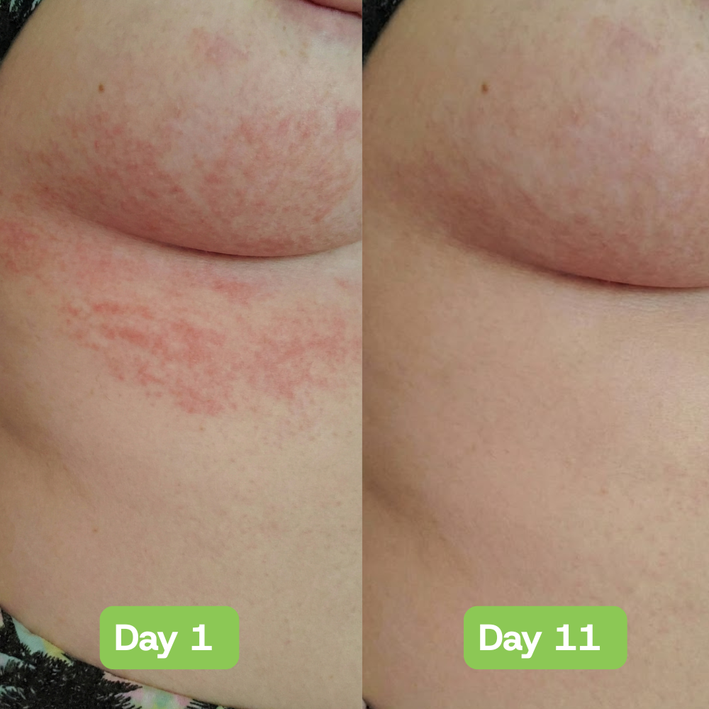 Veloria AntiFungal Relief