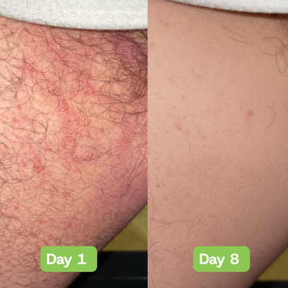 Veloria AntiFungal Relief