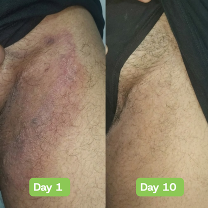 Veloria AntiFungal Relief