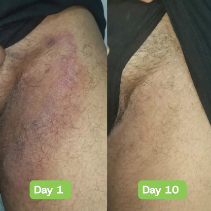 Veloria AntiFungal Relief