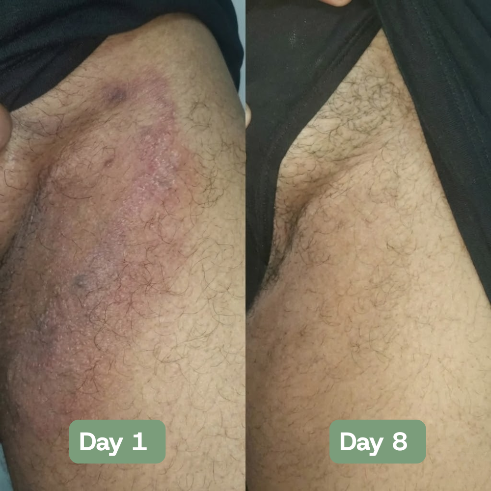 Veloria AntiFungal Relief