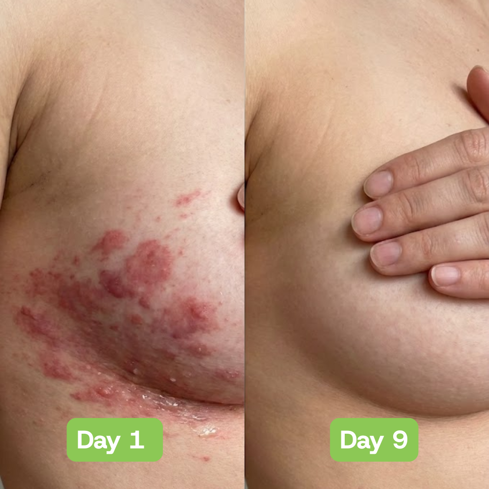 Veloria AntiFungal Relief