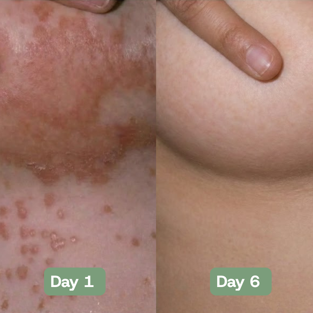 Veloria AntiFungal Relief