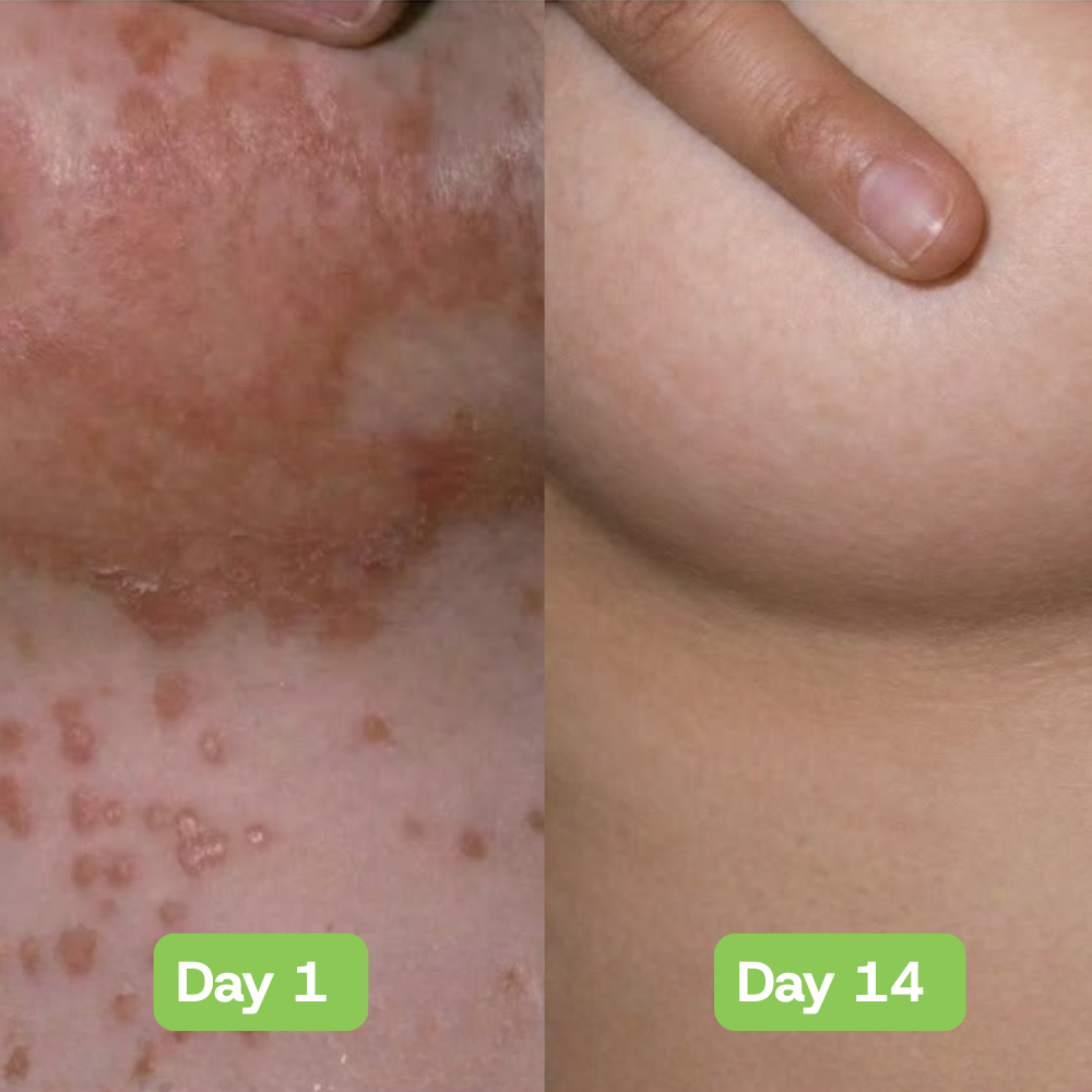 Veloria AntiFungal Relief