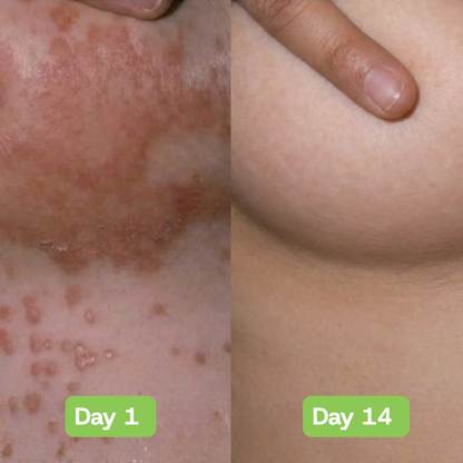 Veloria AntiFungal Relief