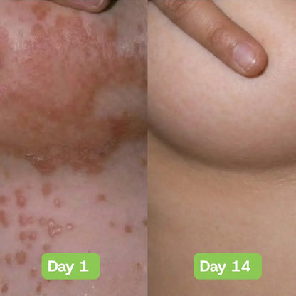 Veloria AntiFungal Relief