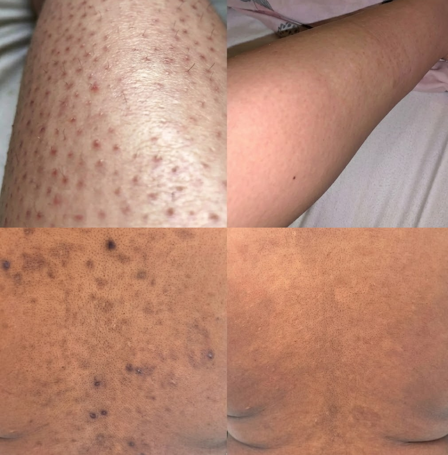 Veloria Exfoliating Shower Band